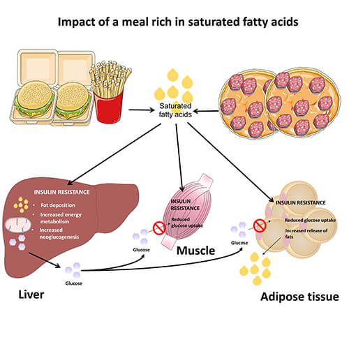 fatty liver - Nash24x7