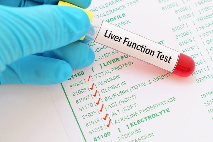 TESTS FOR FATTY LIVER