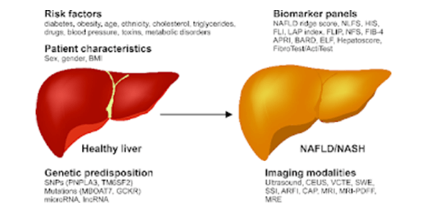 What are the causes of NAFLD