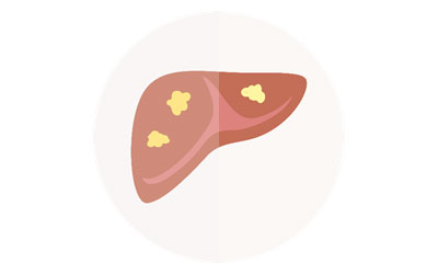 is fatty liver a serious disease