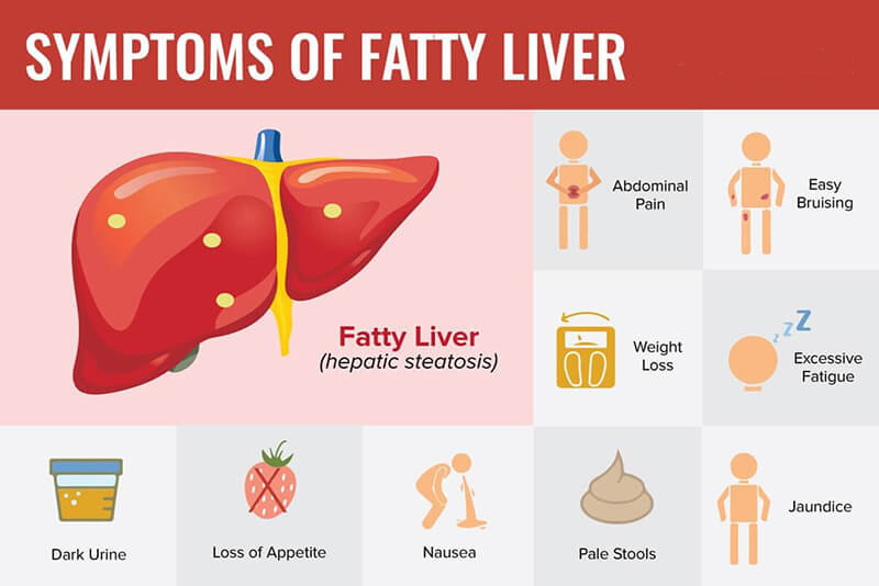 How Nash and fatty liver effects daily functioning of the liver