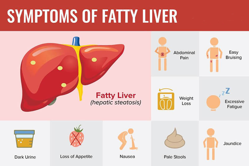 symtoms of fatty liver