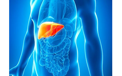 Non-alcoholic fatty liver disease