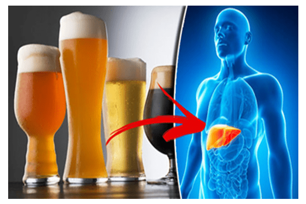 alcohol effects on liver