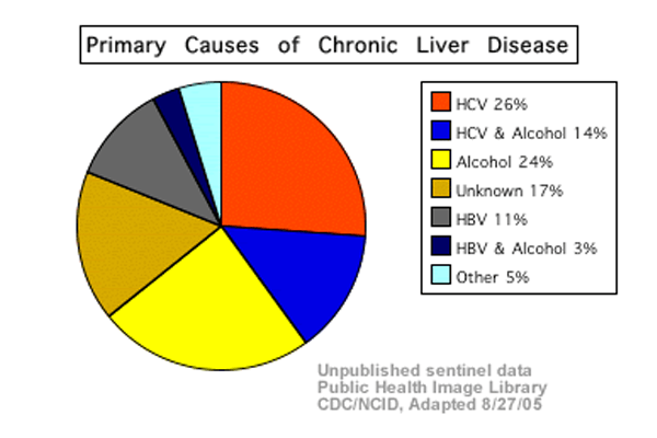 Causes of cirrhosis