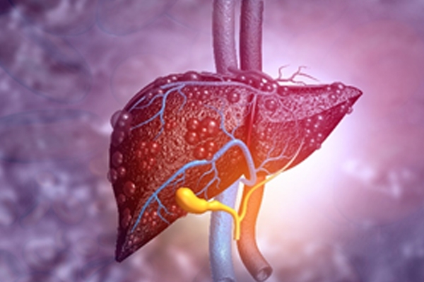 Liver Cancer Treatment