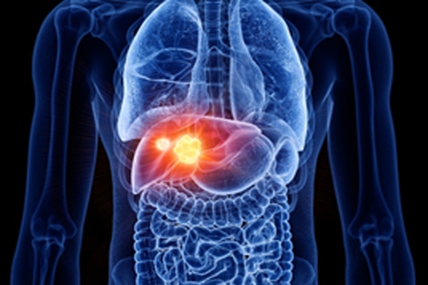 liver cancer symptoms