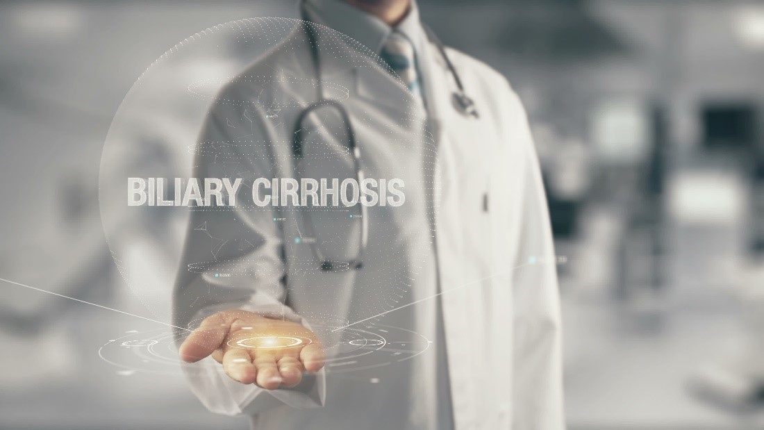 Understanding biliary cirrhosis and how it affects life