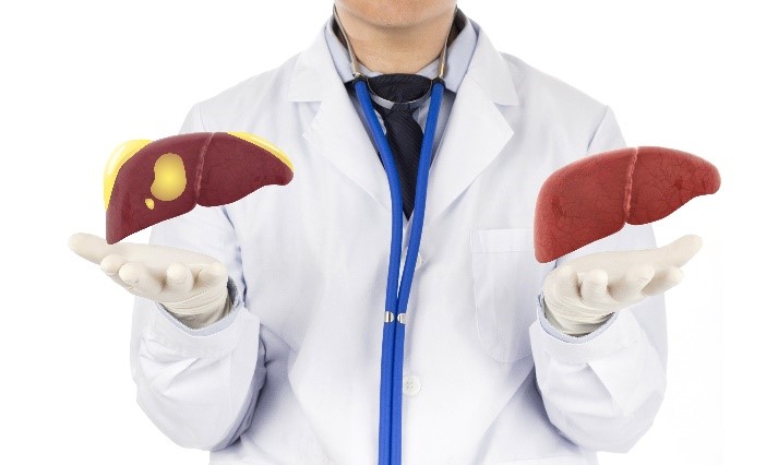 Healthy Liver Vs Fatty Liver, how to determine the deference